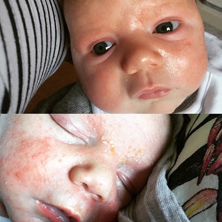 Kokoso Baby Kokosový olej výsledky_1